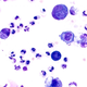Illustration for article titled More Evidence that a Common Cat Parasite Could Increase Your Risk of Suicide